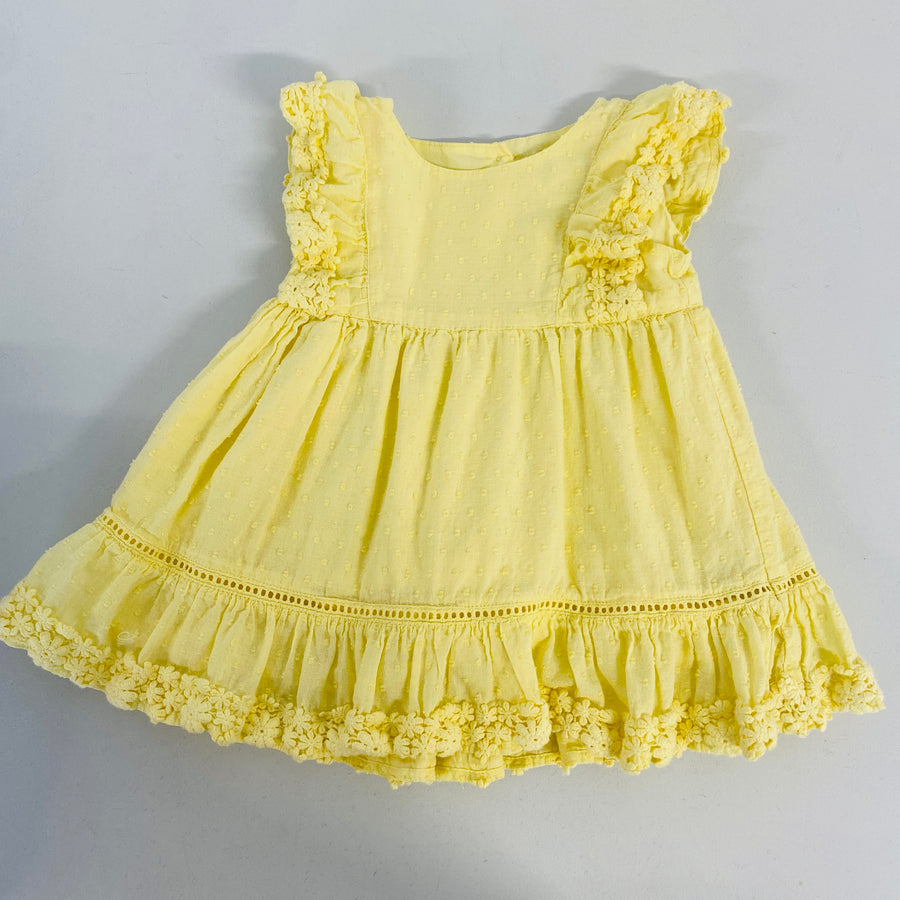 Sun Dress | 6-12mos